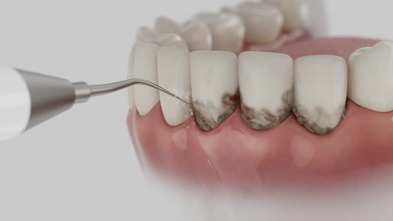 Reliable Dental contractor in Frostburg, MD by Dentist Open Now